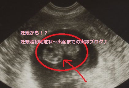 妊娠初期8 9週目の胎児の様子 妊娠かも 妊娠超初期症状 出産までの実録ブログ