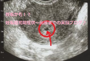 妊娠4週目 妊娠2ヶ月 の胎芽の様子 妊娠かも 妊娠超初期症状 出産までの実録ブログ